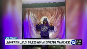 Toledo woman hosts wig giveaway for lupus patients during awareness month
